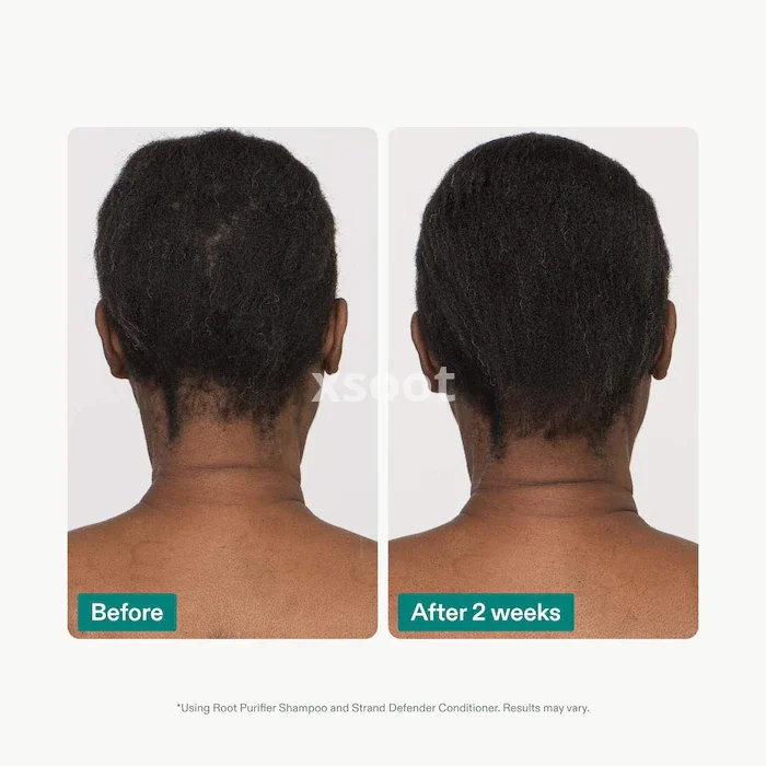 Buy Volumizing Shampoo & Conditioner Duo for Thinning Hair
