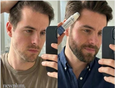Buy Newplum Advanced Hair Growth Roll-On Serum Online